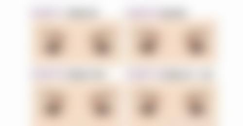 西安艺星宋蔚做双眼皮，手术流程是怎样的？