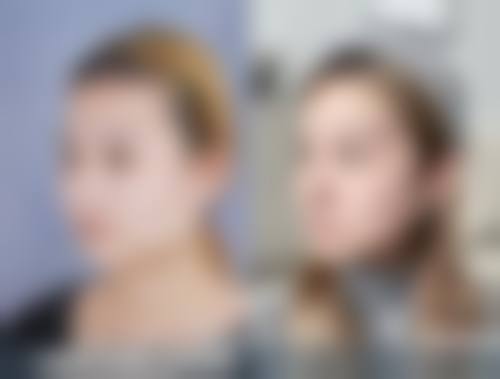 北京圣嘉新医疗美容医院下颌角磨骨选哪位医生好？了解医生团队