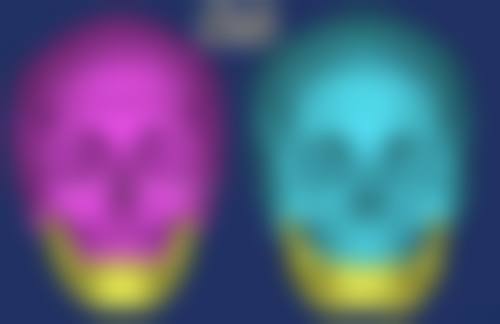 北京圣嘉新医疗美容医院下颌角磨骨价格贵吗？了解手术价格