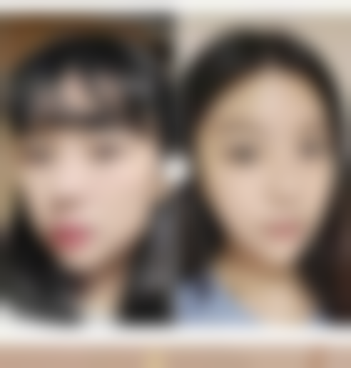 北京圣嘉新医疗美容医院下颌角磨骨体验如何？看看医院环境与设施