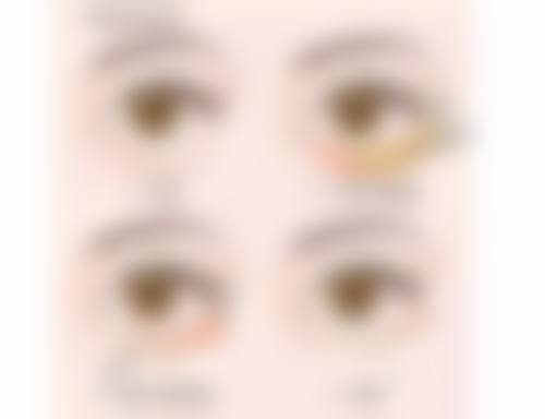 青岛海天医学整形美容中 心正规吗？