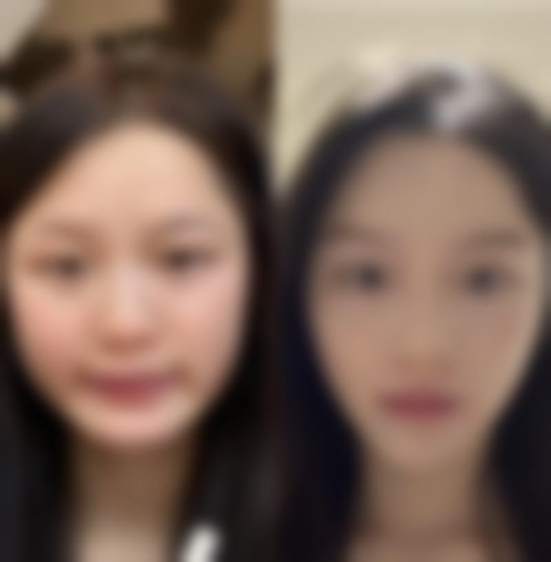 北京广济中医和西医结合医院胎记疤痕诊疗中 心怎么预约