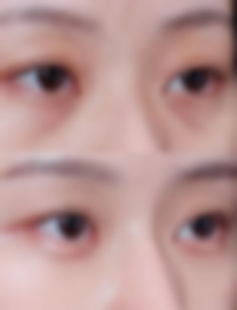 南宁余德庆(米兰柏菲)医疗美容诊所正规吗？