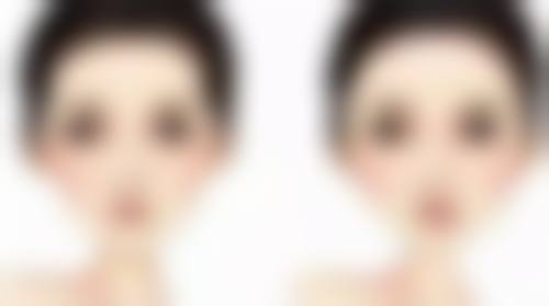 为什么做脸部抽脂要选择正规医院和专精医生?