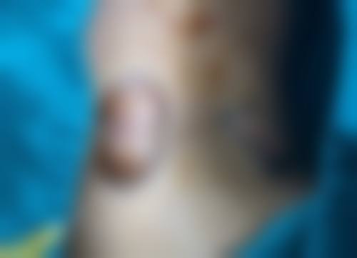 华南地区有哪些做大腿吸脂出色的国有三等甲医院科室？