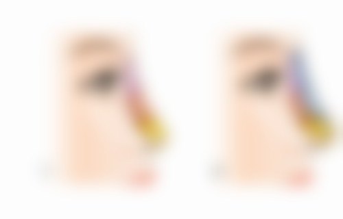 沈阳创美医疗美容门诊部陈鸿医生预约挂号指南