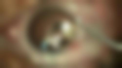 郑州曼蒂整形美容医院口碑评价怎么样？