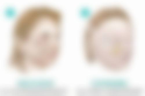 吉林大学第一医院李树全医生患者评价