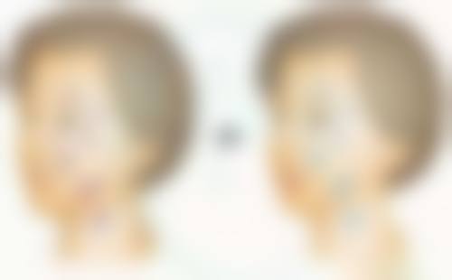 宁波美仁整形美容医院李观龙医生收费价格