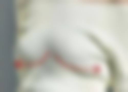 重庆威妮医疗美容诊所尹莉医生自体软骨垫鼻尖技术怎么样？