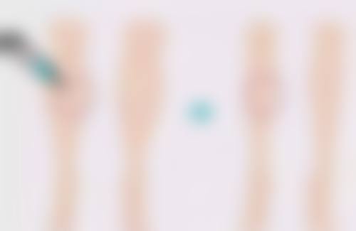 自贡市第四人民医院整形美容科何建霖医生擅长项目