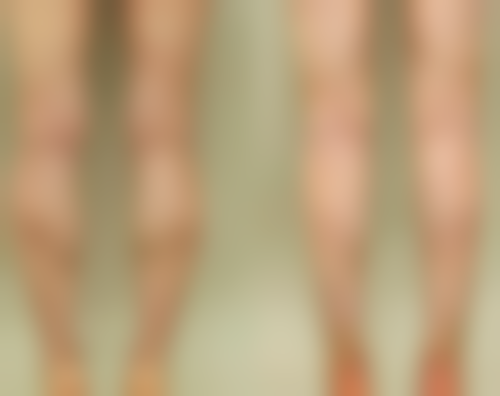 那有什么办法可以预防祛眼袋手术后复发呢？