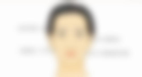 35岁的女人做双眼皮好吗？答案是好，能提升气质、增添魅力还不影响健康恢复！ 