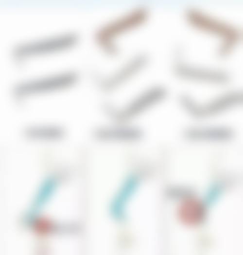 60岁割双眼皮需要关注哪些身体因素？