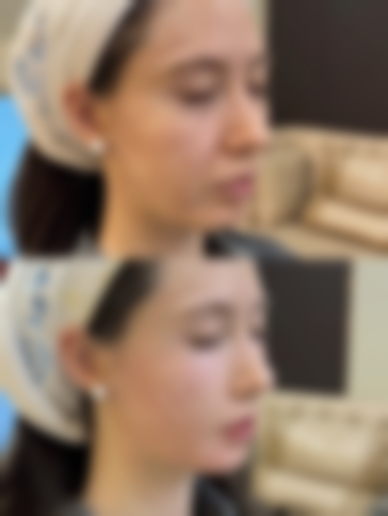 武汉大麦医疗美容门诊部周玉太医生收费价格