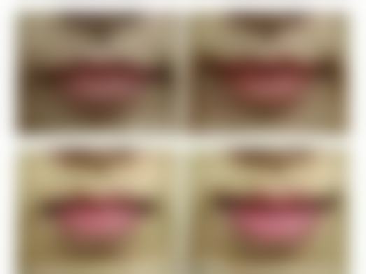 东莞莞南皮肤病医院在脸部疤痕疙瘩治疗方面有什么优势？