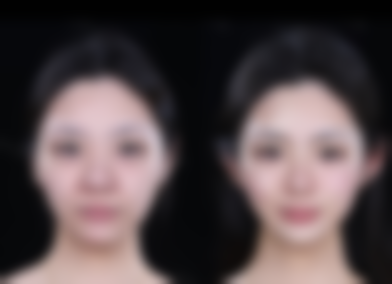 自贡市第四人民医院整形美容科何建霖医生预约挂号指南