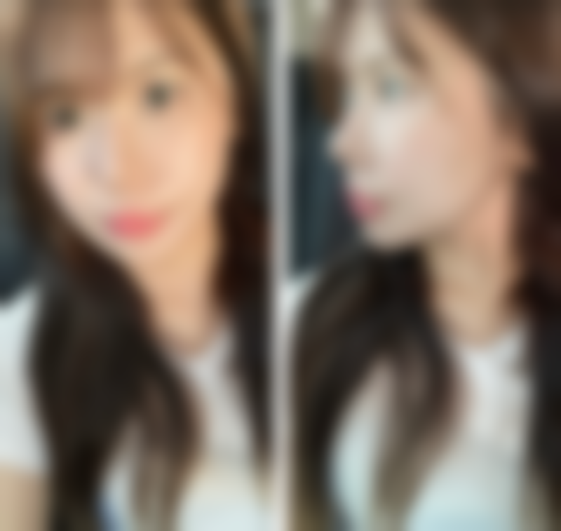 小孩疤痕修复涂什么好？硅酮凝胶、积雪苷霜软膏，这些或许是不错的选择！ 