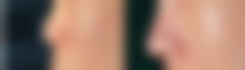 韩国ANSWER整形外科医院正规吗？