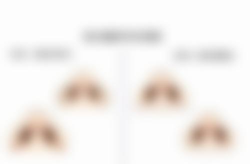 做双眼皮手术可能会有哪些间接因素影响月经呢？