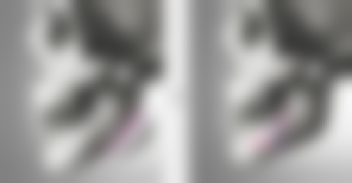 打瘦脸针后除了睡姿，还有哪些护理建议呢？