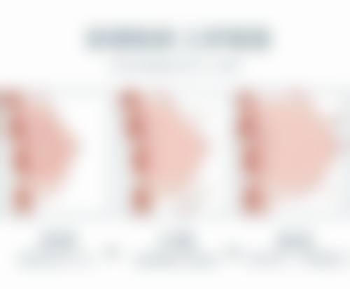 北京欧普曼医疗美容诊所口碑评价怎么样？