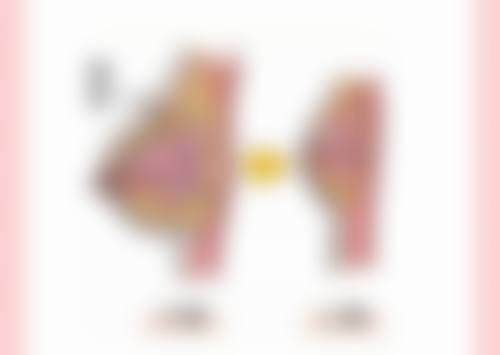 打瘦脸针后0 - 24小时可以侧着睡吗？