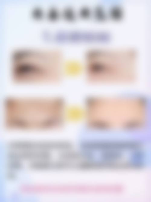 不同观点对六点定位双眼皮维持时间有哪些看法？