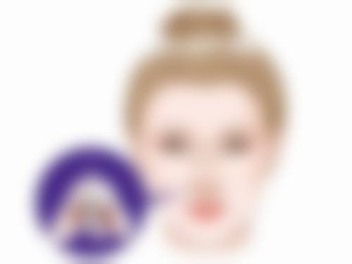 出现哪些情况需要关注并取出假体呢？