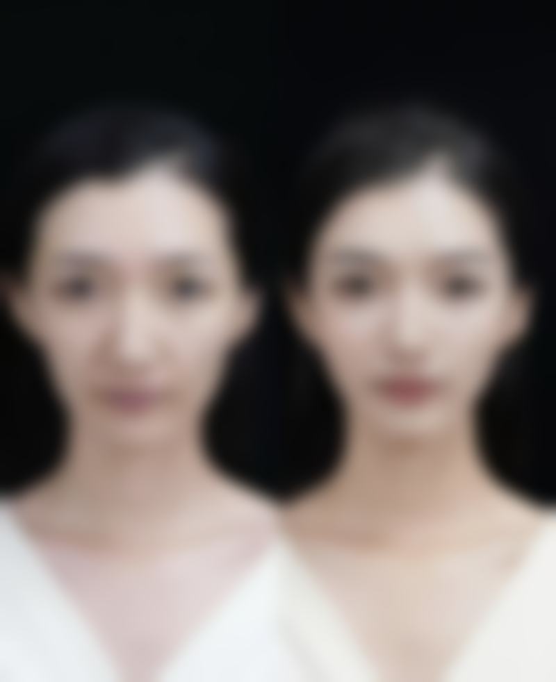 疤痕红怎么能彻底消除掉？试试激光治疗、涂抹药膏，这些方法或许有效！ 