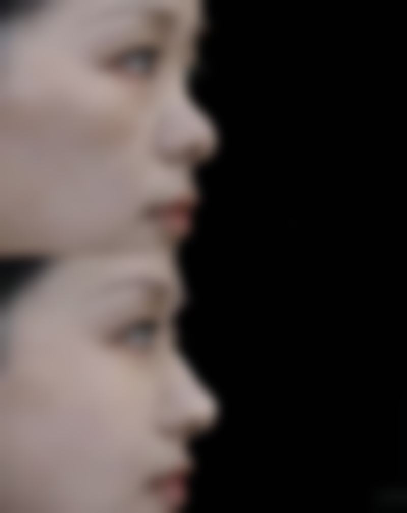 隆胸风险大还是隆鼻？如何选择适合自己的手术项目并降低风险你了解吗？ 