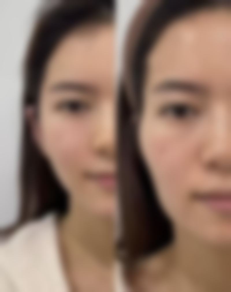 空军航空医学研究所附属医院激光美容中 心正规吗？