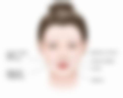 重度的热油疤痕怎么干预？