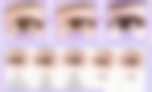 怎样结合自身情况设计双眼皮的宽度呢？