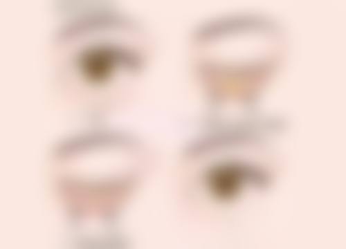 术后1 - 3天眼皮红肿疼痛该怎么处理？