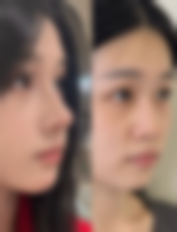 泰国Preecha美容研究所(PAI)口碑评价怎么样?