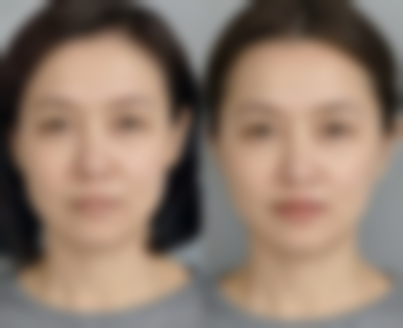 韩国SMPS整形外科歇业医生介绍