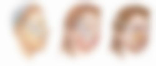 不同类型的眼袋有哪些成因和科学改善方案？