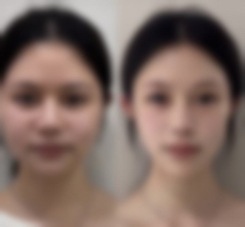 问：日常按摩能去除眼袋吗？