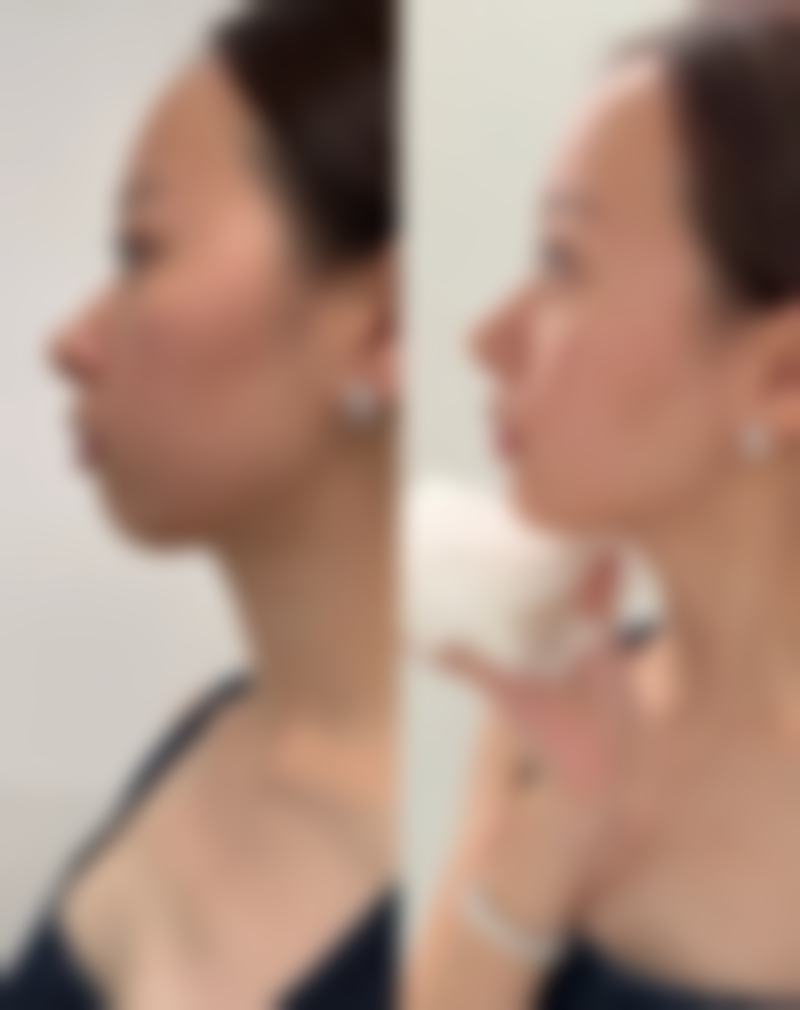 宝鸡丽人医院医疗美容科正规吗？