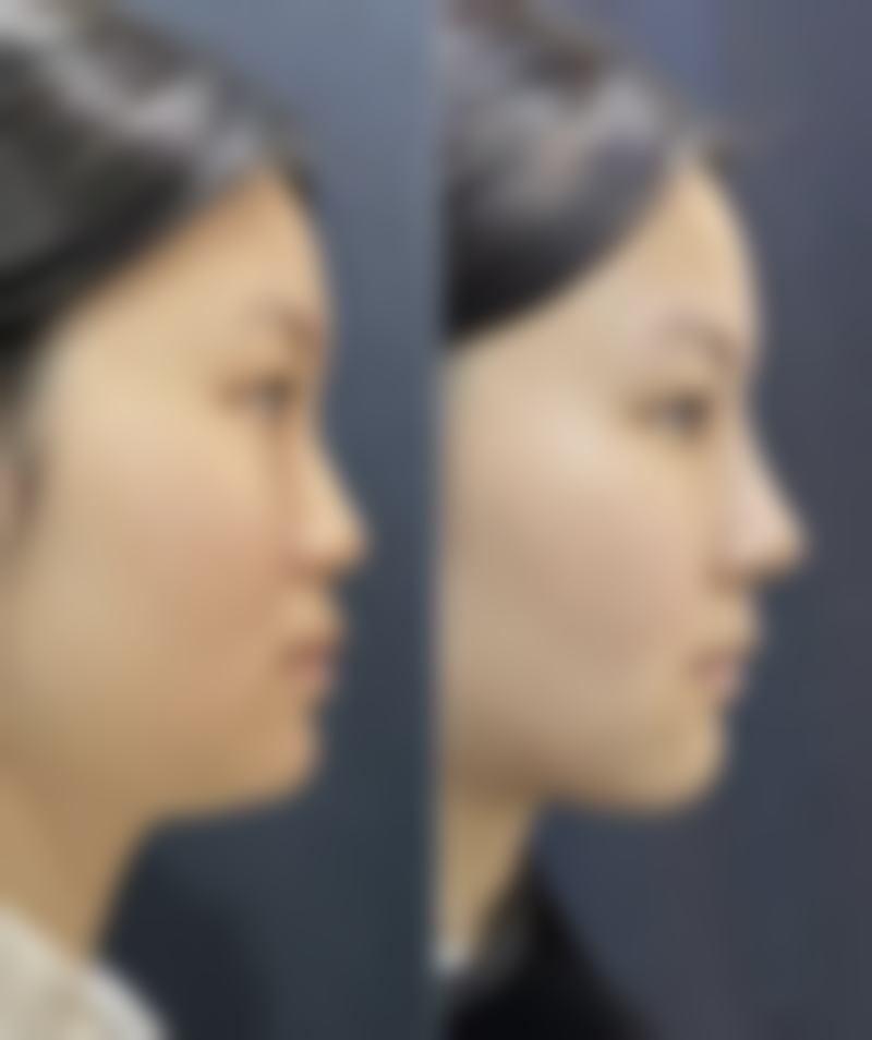 云南省玉溪市人民医院口碑评价怎么样？