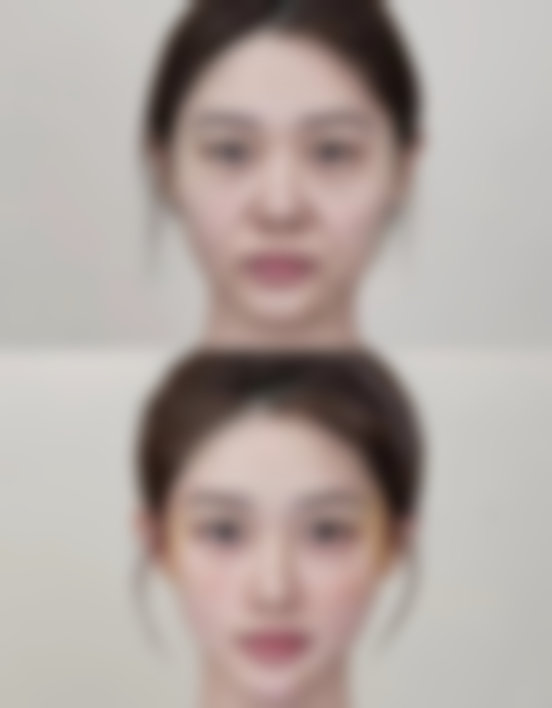 问：调整作息对去眼袋有帮助吗？