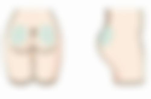 疤痕增生有哪些症状表现？