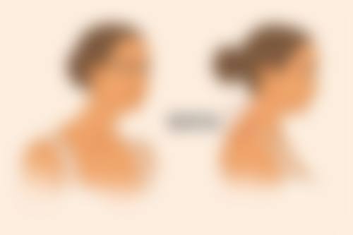 影响局部抽脂术后成效的关键因素有哪些？