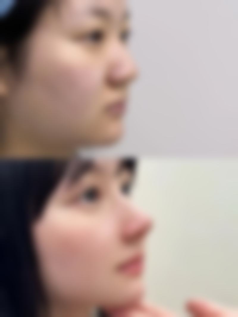 韩国清潭es皮肤科口碑评价怎么样?