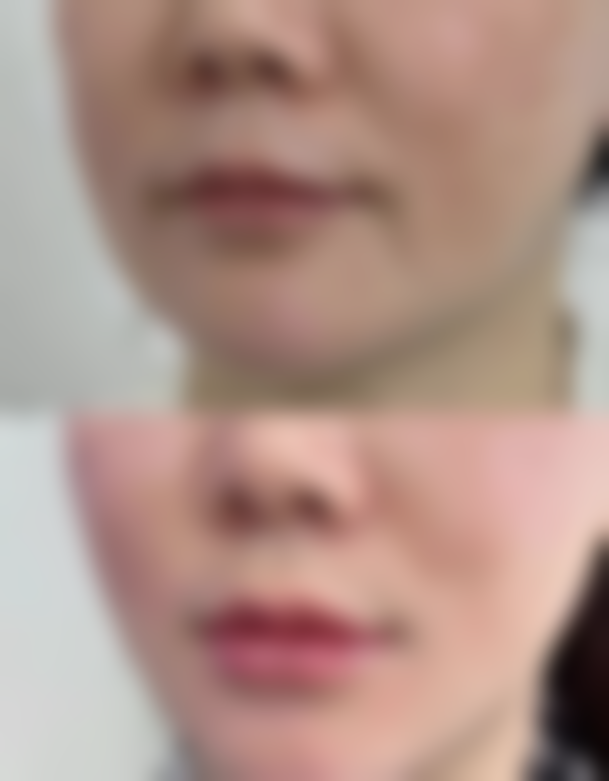 临汾市现代女子医院整形科 怎么预约