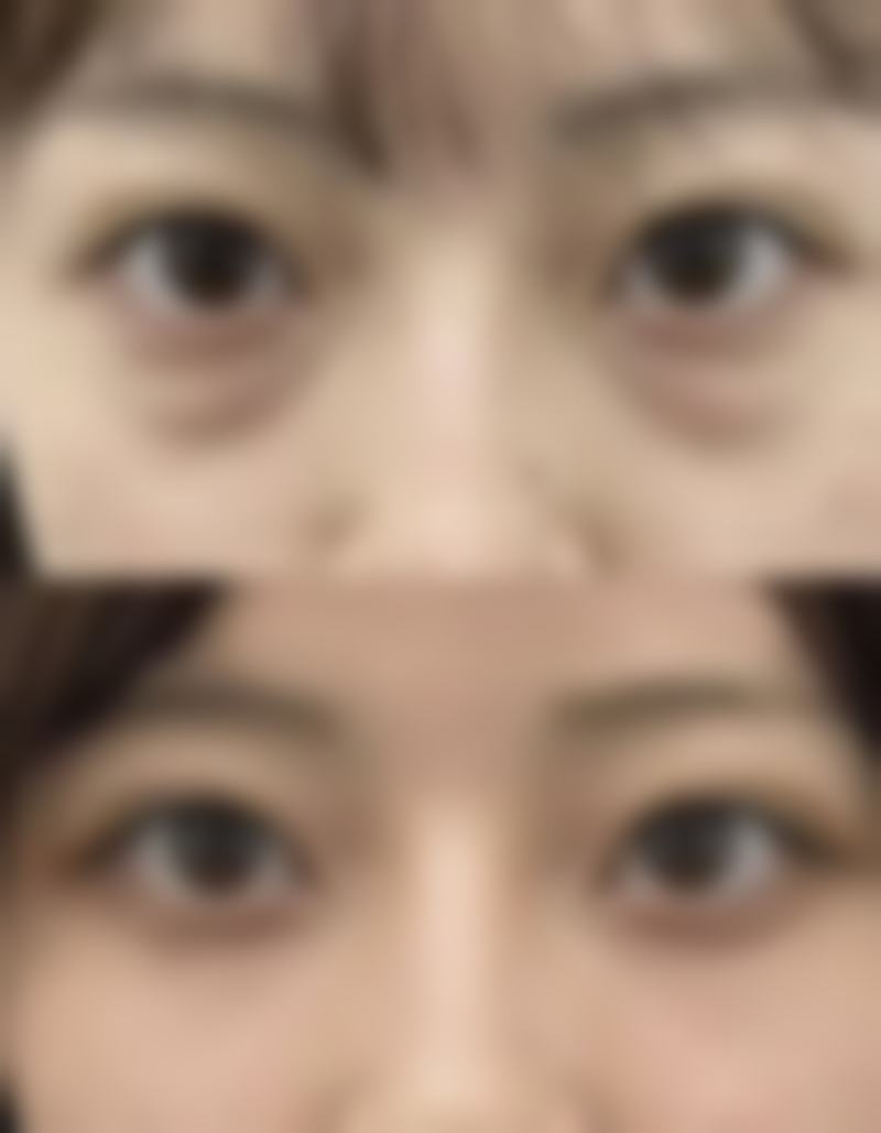 二次修复次数有限制吗？