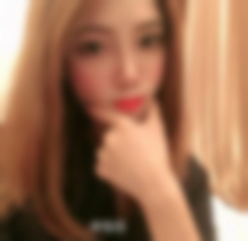 广东韩妃医疗美容医院鼻综合整形实例分享：术后山根立体容貌升，服务贴心让人超满意！总结来啦！