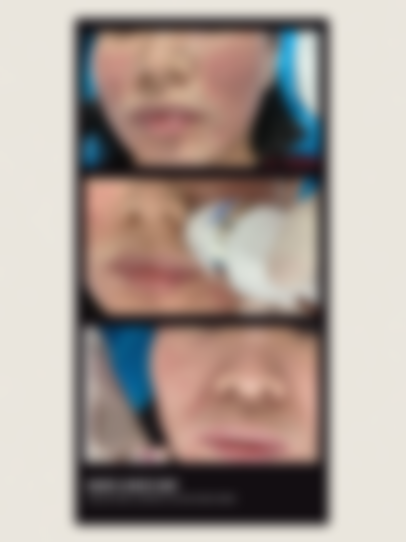 广东韩妃医疗美容医院蒋水清主事超声炮抗衰，体验过程咋样呢？