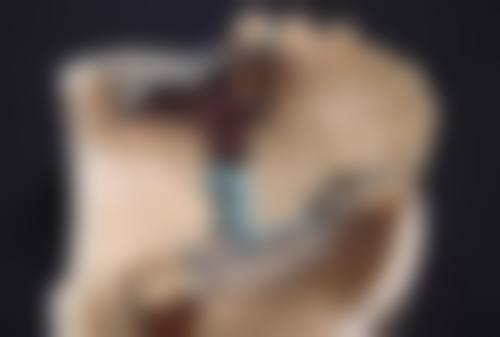 那双眼皮贴的作用原理是怎样的，为什么不能持久呢？